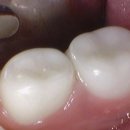 일산어린이치과의원 이미지