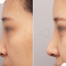 비더뉴의원 이미지