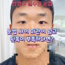 뷰티문 네이버블로그