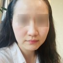 최은화피부관리 | 당진피부관리 당진인셀덤 수청지구점 체험 솔직한 후기