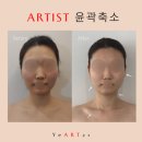 예아트21 | [매끄롬 포항효자점]효자동피부관리/얼굴윤곽전문점에서 관리받고 얼굴이 정말 작아졌어요.