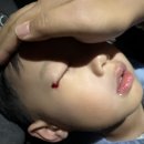 아문성형외과의원 이미지