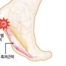 바디모어핏 이미지