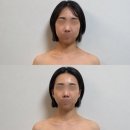 여헌로-2 | 구미 피부관리 더에스테틱온에서 싸이블로 리프팅 받은 후기!