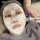 울트라클리어 기미도 옅어지고 결도 개선해주는 역대급 레이저후기