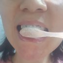 보나오라 | 키토자생치약 시린 이 이제 안녕