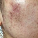 와이저, 똑똑한 조직은 어떻게 움직이는가 | (실사후기) 아크덤겔 따가운 부작용 없이 화농성여드름 해결 사용법