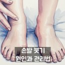 건강한손발마사지 | 손발이 부어요 원인과 관리법 핵심만 정리!