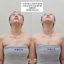 여며들다 116 | 양산 에스테틱 얼굴비대칭관리 두골비 여며들다116