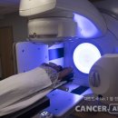 유방암 환자는 어떤 경우 방사선치료를 할까? 이미지