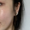 아이원헬스케어 이미지