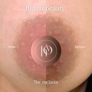 하이유뷰티 | [공지] 천안 불당동 유륜·유두 멜라닌 케어, 1회 만에 밝아진 변화✨