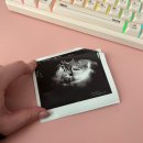 유산 | 5주차 임테기, 초음파 확인 /7주차 계류 유산, 소파술 후기