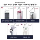 모반개발