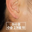 강동실비