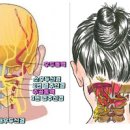 오른쪽 왼쪽 뒷머리 찌릿 통증 원인 대처 이미지