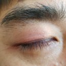 강 안과의원 이미지