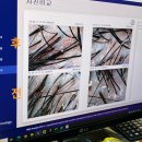 효과100% 만족스러웠던 산본 두피관리 /닥터모락 산본점
