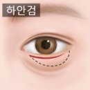 50대하안검수술후기? [전후 사진 모음]