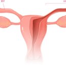 여자 왼쪽 아랫배 통증 : 남자 오른쪽 아랫배 통증 이미지