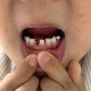 동구이편한치과의원 | 구리 교문동 어린이치과 추천, 6세 아들 검진 후기 (서울이편한치과의원)