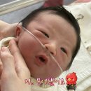 대구가톨릭대학교병원 | 출산 신생아 빈호흡 황달｜대구가톨릭대학교병원 NICU 입원 12박 13일 치료 후기