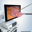 LTF-190-10-3D ENDOEYE FLEX 3D, 3D Videoscope 이미지