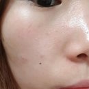지성피부토너, 은율 옐로우씨드 테라피 바이탈 토너(각질제거, AHA,BHA,PHA 성분함유)