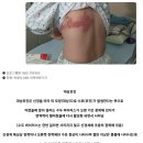 최근 20~30대에게 급증하고 있는 심각한 질병 (약혐).JPG 이미지