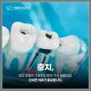 민플란트치과의원 이미지