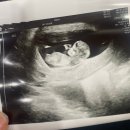 신기의료기 대전점 | 대전 충남대병원 산부인과 (기형아검사,혈당검사,백일해주사 접종,태동검사,3d 입체초음파,입원 준비물...