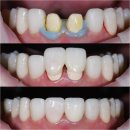 수정기공사 이미지