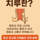 차오름한방병원 | 치루란? 재발했지만 한고로 잡은 5개월 회복기