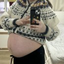 더블유병원 | 광주 더블유 여성병원 제왕절개 후기