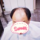 김호증모가발춘천체인점 이미지