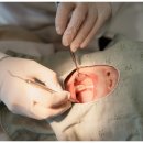 미소인치과기공소 이미지