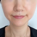 구래동모공관리 초이스뷰티에서 블랙헤드 관리받고 다음날 더 만족했던 후기 ✨