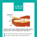 핀포인트 이미지