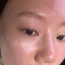 셀리즈피부과의원 | 해운대 마린시티 피부과 리프팅 더블타이트로 유명한 곳