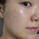 아셀 - 안양시 동안구 평촌대로374번길 9-7 | 홍대피부과 스킨부스터 쥬브아셀 솔직후기
