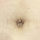 주덕성모외과의원 | 인천탈장수술 성모K외과에서 깔끔하게 마무리했어요