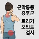 근막통증증후군(MPS), 진짜 원인은 ‘트리거포인트’일까요? 트리거포인트 검사 완전정리 이미지