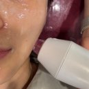 (주)대세엠·케어 | 부산 연산동 H뷰티엠 피부 수분,콜라겐 탄력 관리 콜드플라즈마샤워 후기