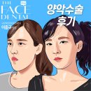 [압구정양악치과] 더페이스치과에서 진행한 양악수술 후기가 궁금하다면