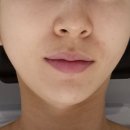 포바디클리닉 | 두피 가려움 안녕! 포항 헤드스파 차쌤 뷰티 2번째 재방문 후기.