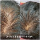 #아우라아인 | 큐사랑 포항
