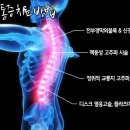 하늘통증크리닉 네이버블로그