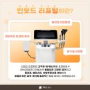 인덕원동은정형외과의원 | 인모드리프팅 전후 30대 40대 턱라인 개선 어떻게?