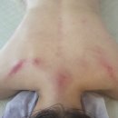 유림에스테틱 - 익산시 하나로10길 3 | [부산 수영역 에스테틱] 약손관리로 목·어깨 통증 달라진 약손유림에스테틱 등관리 솔직 후기
