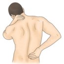 요통[Low back pain]근골격질환 이미지